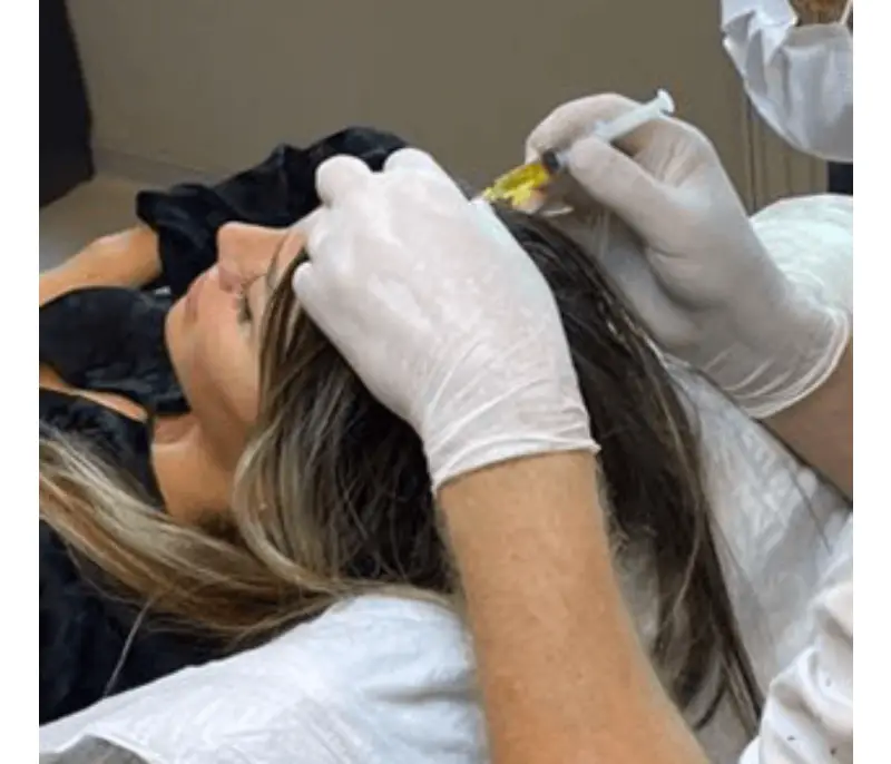 mesotherapy in istanbul