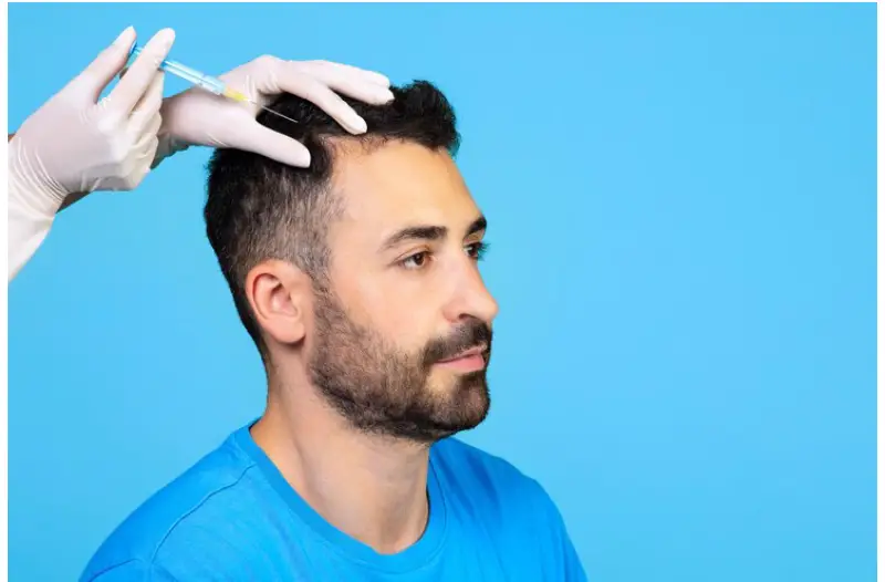FUE hair transplant in Istanbul